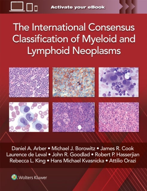 The International Consensus Classification of Myel