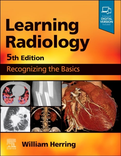 Learning Radiology - Recognizing the Basics