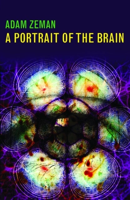 A Portrait of the Brain