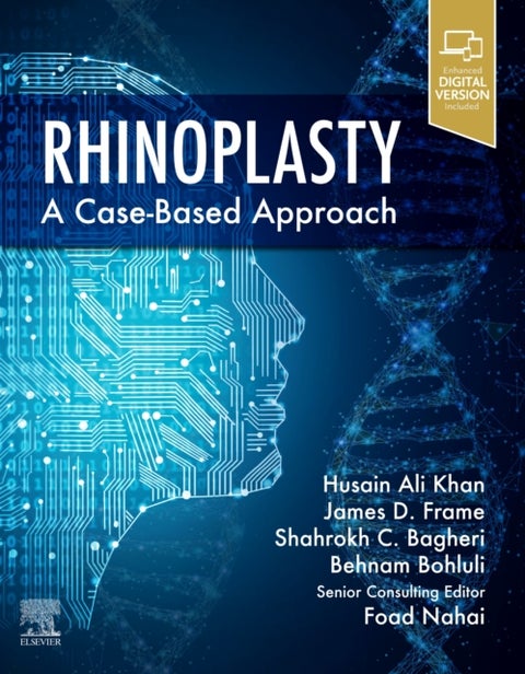Rhinoplasty - a Case-based approach