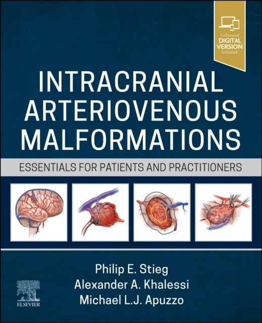 Intracranial Arteriovenous Malformations - Essentials for Patients and Practitioners