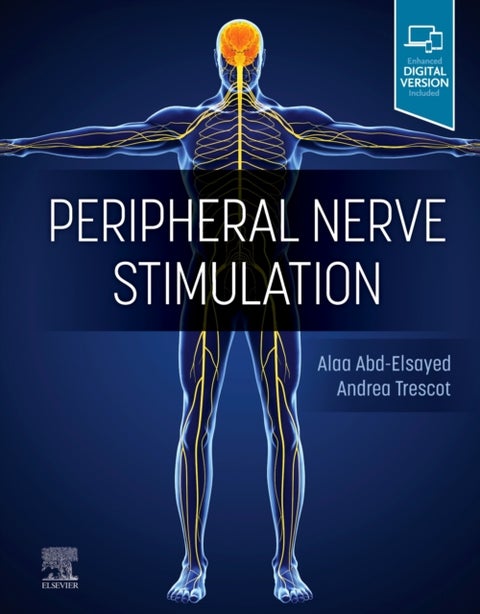 Peripheral Nerve Stimulation - A Comprehensive Guide