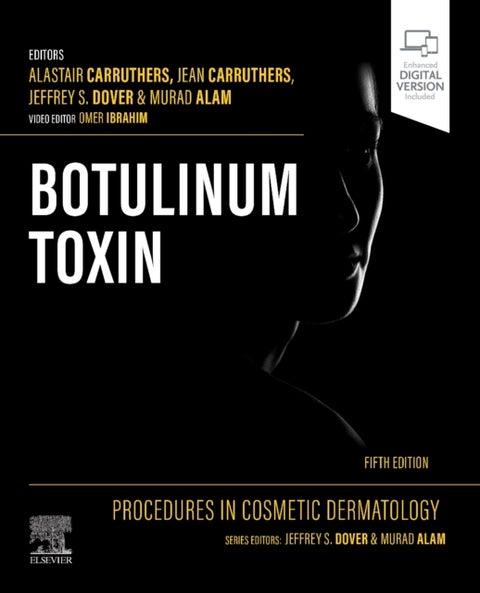 Procedures in Cosmetic Dermatology: Botulinum Toxin