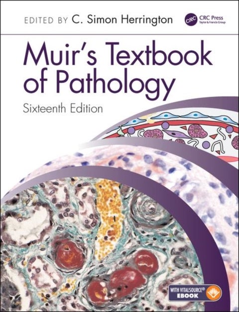 Muir's Textbook of Pathology - Sixteenth Edition International Student Edition