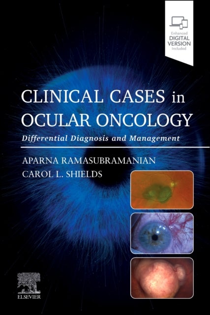 Clinical Cases in Ocular Oncology - Differential Diagnosis and Management