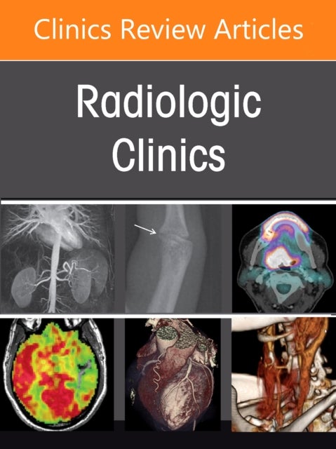 Imaging of the Orbit, An Issue of Radiologic Clinics of North America