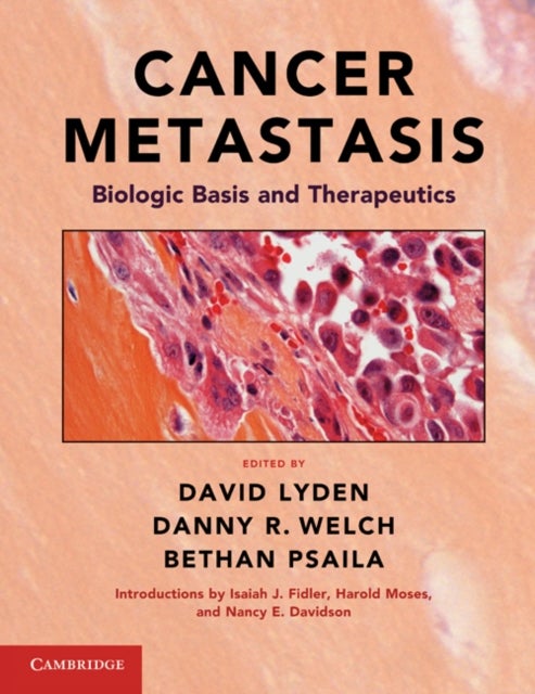 Cancer Metastasis - Biologic Basis and Therapeutics