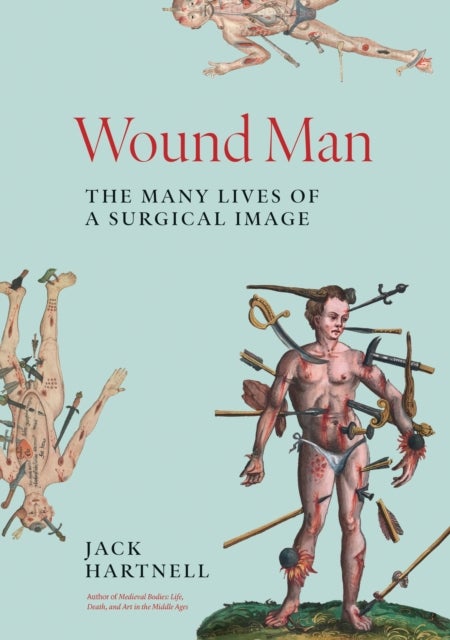 Wound Man - The Many Lives of a Surgical Image