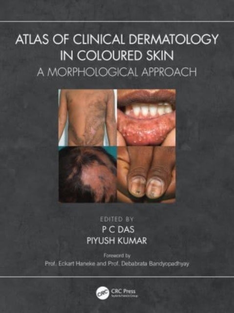 Atlas of Clinical Dermatology in Coloured Skin - A Morphological Approach