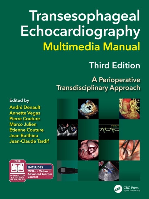 Transesophageal Echocardiography Multimedia Manual - A Perioperative Transdisciplinary Approach