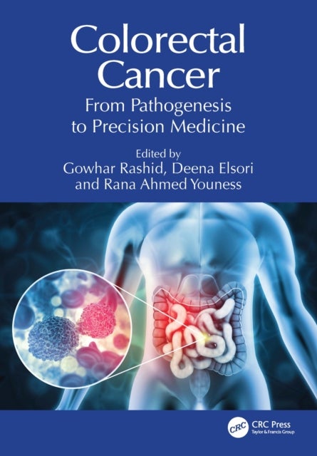 Colorectal Cancer - From Pathogenesis to Precision Medicine