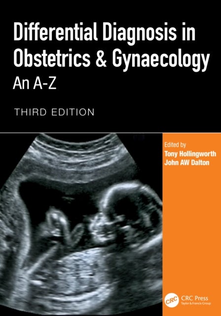 Differential Diagnosis in Obstetrics & Gynaecology - An A-Z