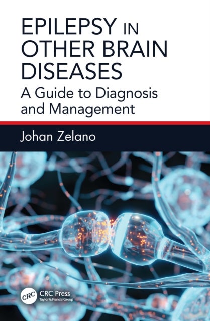 Epilepsy in Other Brain Diseases - A Guide to Diagnosis and Management
