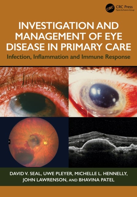 Investigation & Management of Eye Disease in Primary Care - Infection, Inflammation and Immune Response