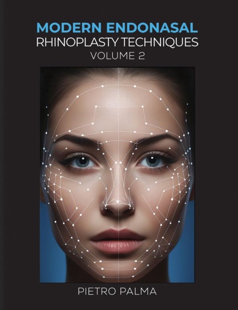 Modern Endonasal Rhinoplasty Techniques – Volume 2