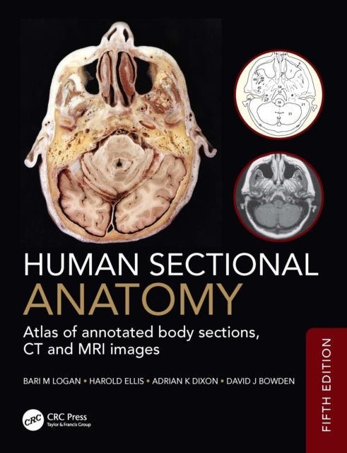 Human Sectional Anatomy - Atlas of annotated body sections, CT and MRI images