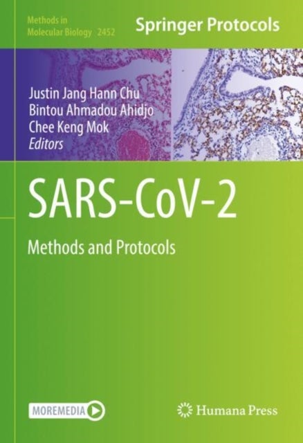 SARS-CoV-2 - Methods and Protocols