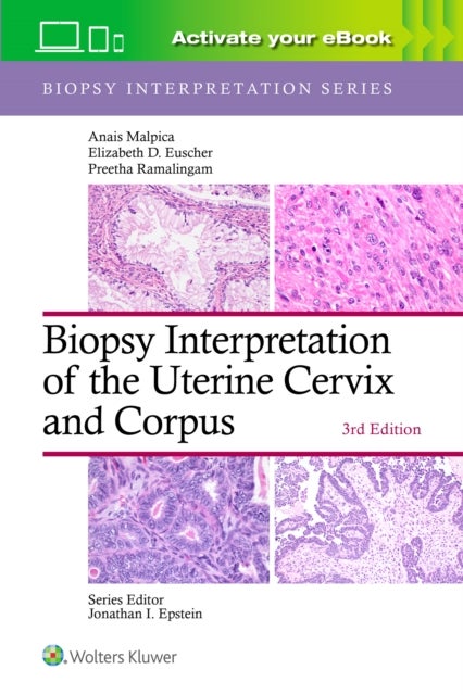 Biopsy Interpretation of the Uterine Cervix and Corpus: Print + eBook with Multimedia