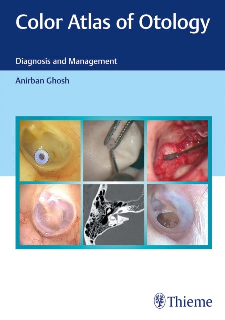 Color Atlas of Otology - Diagnosis and Management
