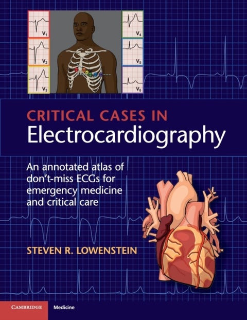 Critical Cases in Electrocardiography - An Annotated Atlas of Don't-Miss ECGs for Emergency Medicine and Critical Care