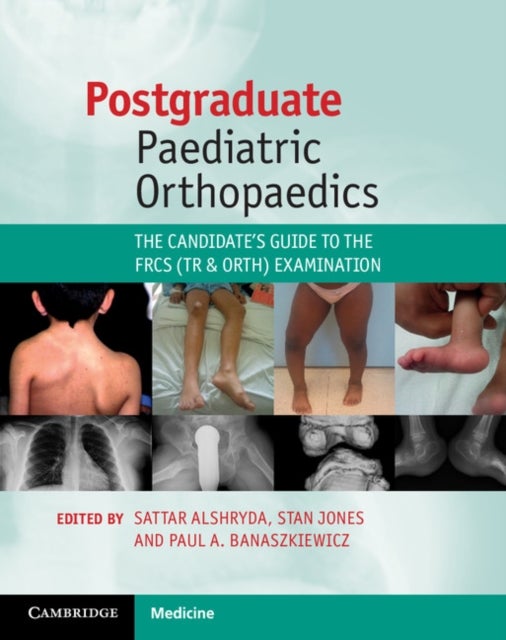 Postgraduate Paediatric Orthopaedics - The Candidate's Guide to the FRCS (Tr and Orth) Examination