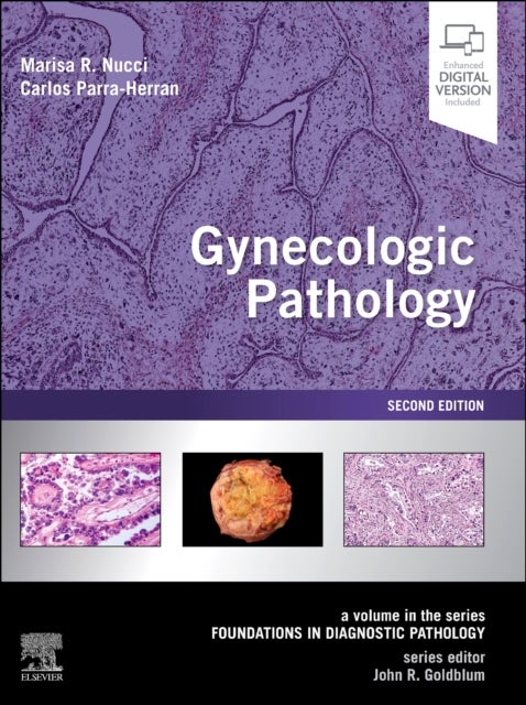 Gynecologic Pathology - A Volume in Foundations in Diagnostic Pathology Series