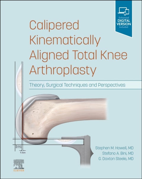 Calipered Kinematically aligned Total Knee Arthroplasty - Theory, Surgical Techniques and Perspectives
