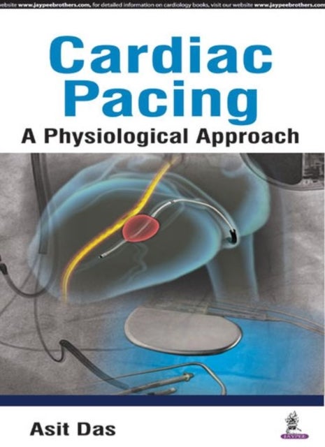 Cardiac Pacing - A Physiological Approach