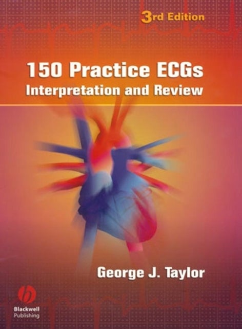 150 Practice ECGs - Interpretation and Review 3e - Interpretation and Review