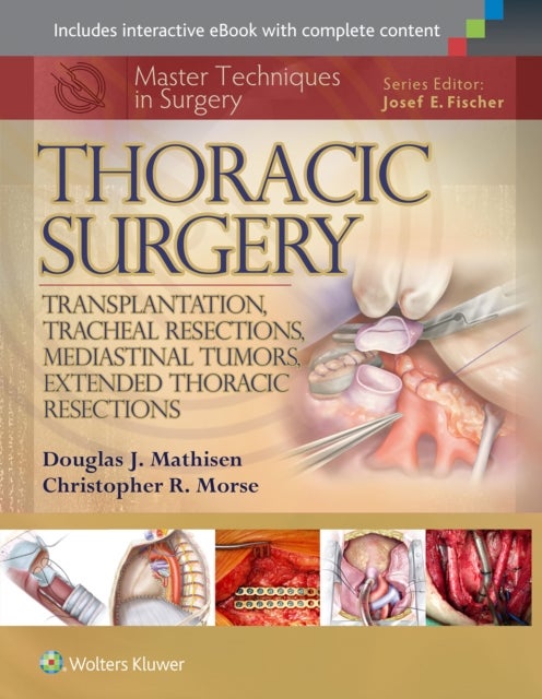 Master Techniques in Surgery: Thoracic Surgery: Transplantation, Tracheal Resections, Mediastinal Tu