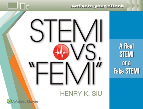 STEMI vs. ¿FEMI¿ - A Real STEMI or a Fake STEMI