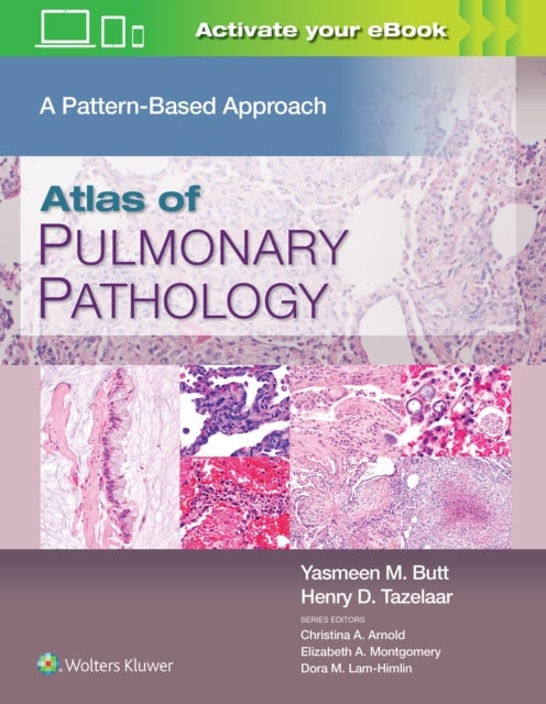 Atlas of Pulmonary Pathology - A Pattern Based Approach