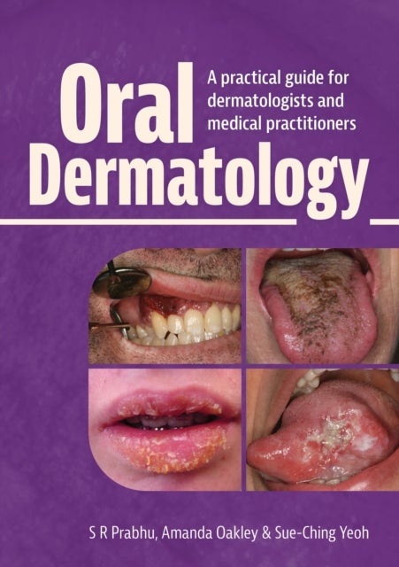 Oral Dermatology - A practical guide for dermatologists and medical practitioners