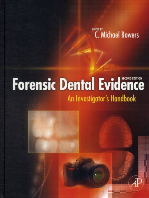 Forensic Dental Evidence - An Investigator's Handbook