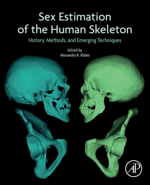 Sex Estimation of the Human Skeleton - History, Methods, and Emerging Techniques