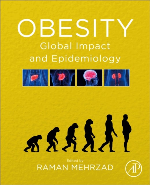 Obesity - Global Impact and Epidemiology
