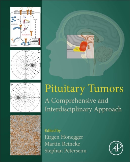 Pituitary Tumors - A Comprehensive and Interdisciplinary Approach