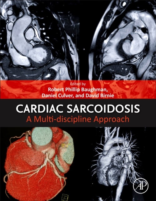 Cardiac Sarcoidosis - A Multi-discipline Approach