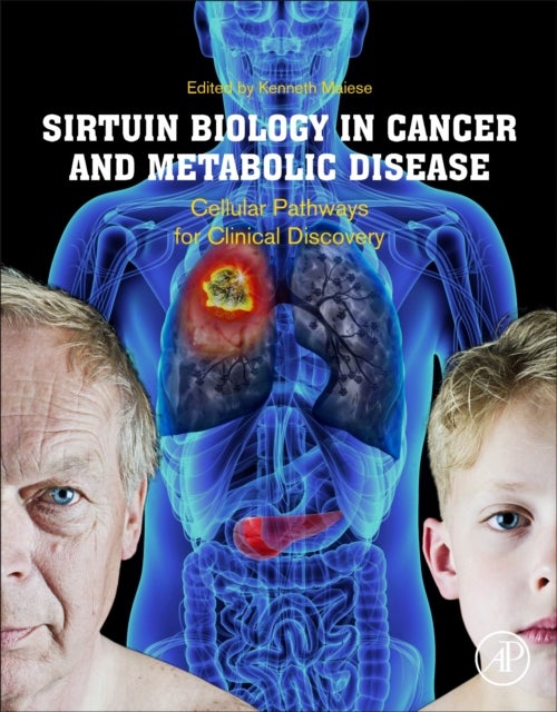Sirtuin Biology in Cancer and Metabolic Disease - Cellular Pathways for Clinical Discovery