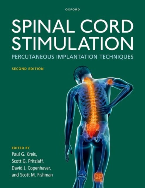Spinal Cord Stimulation - Percutaneous Implantation Techniques