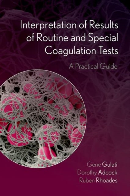 Interpretation of Results of Routine and Special Coagulation Tests - A Practical Guide
