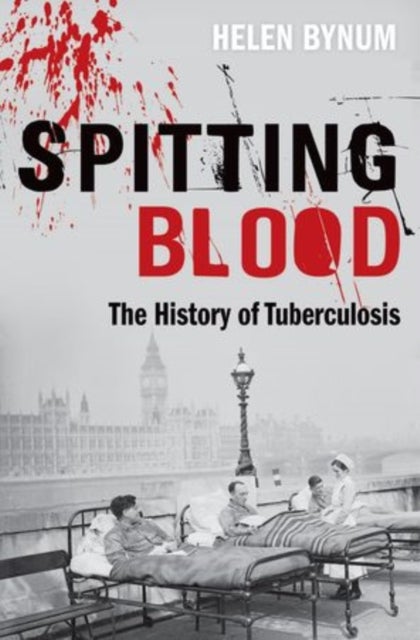 Spitting Blood - The history of tuberculosis