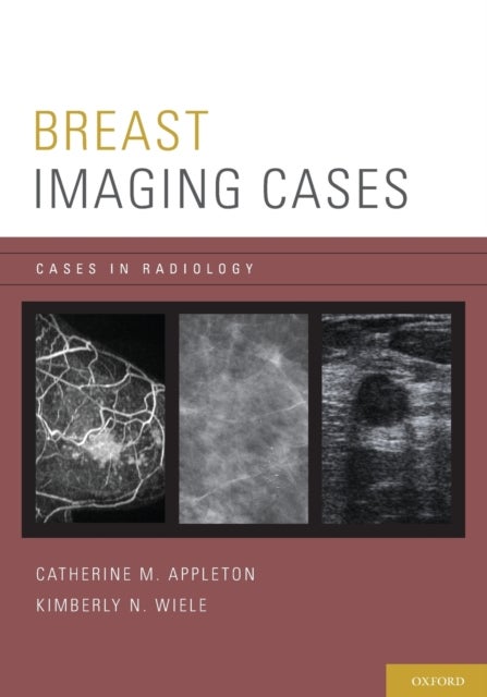 Breast Imaging Cases