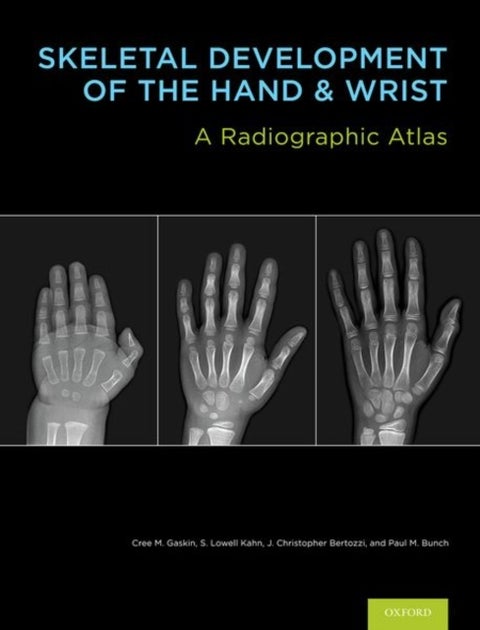 Skeletal Development of the Hand and Wrist - A Radiographic Atlas and Digital Bone Age Companion