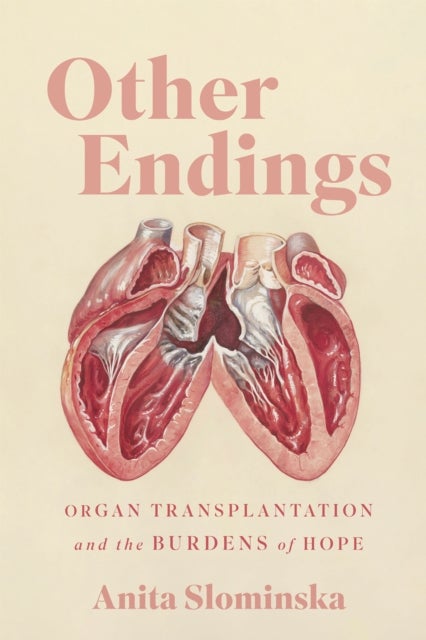 Other Endings - Organ Transplantation and the Burdens of Hope