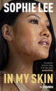 In My Skin