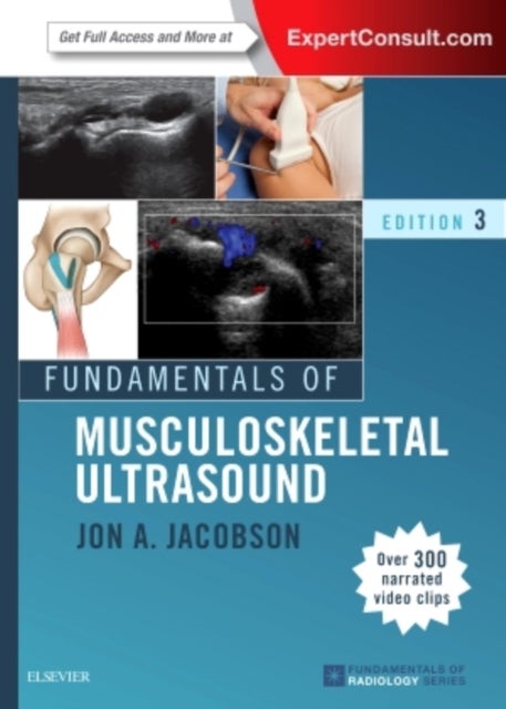Fundamentals of Musculoskeletal Ultrasound 3ed