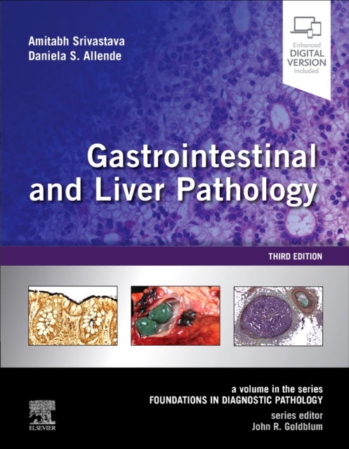 Gastrointestinal and Liver Pathology - A Volume in the Series: Foundations in Diagnostic Pathology