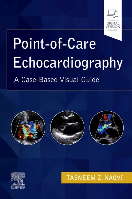 Point-of-Care Echocardiography - A Clinical Case-Based Visual Guide