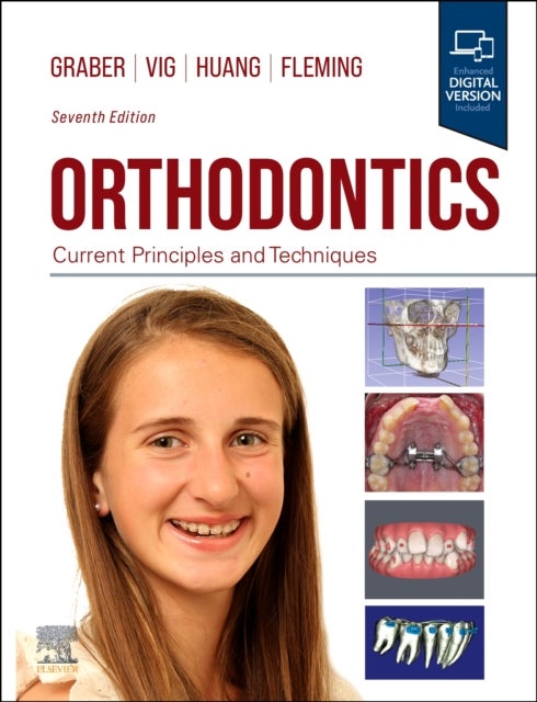 Orthodontics - Current Principles and Techniques